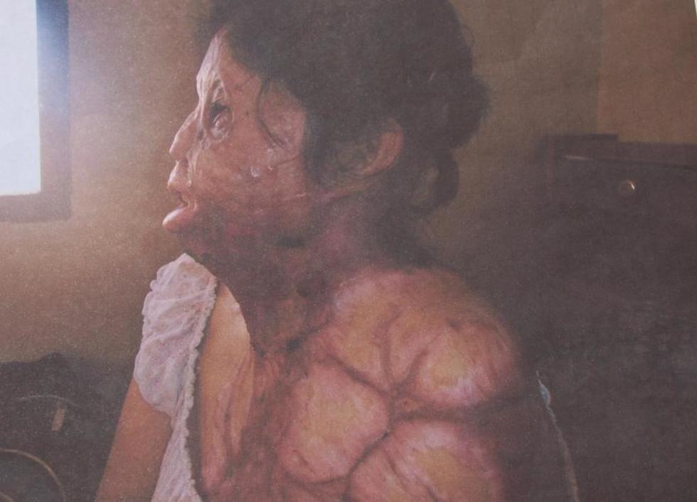 Pareja desfigura el rostro de una mujer con ácido
