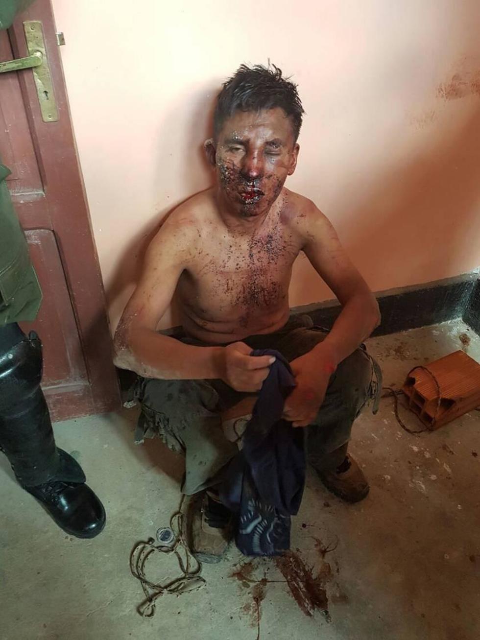 Los policías golpeados están en sala de terapia