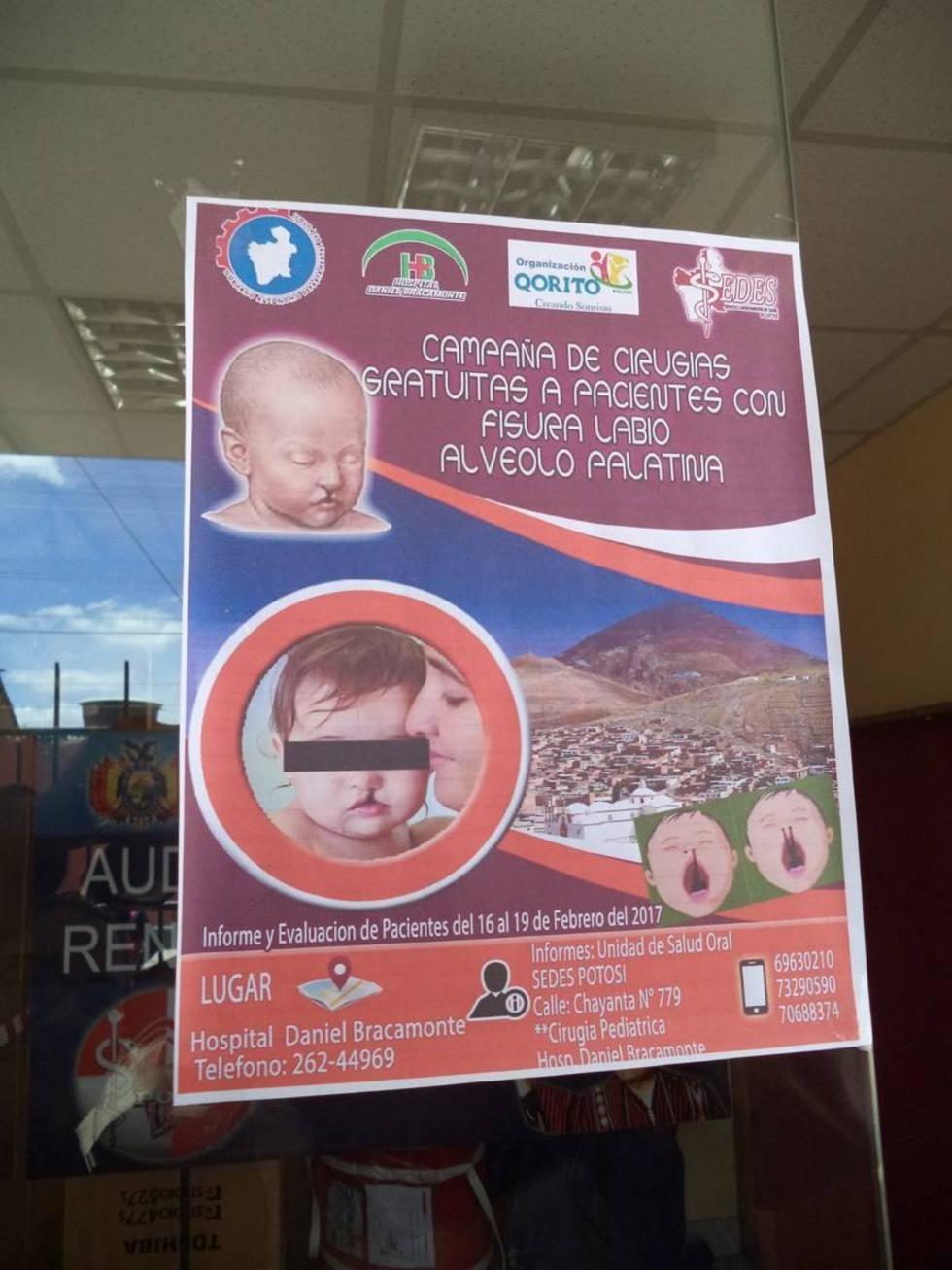 Relanzan campaña gratuita de cirugías de labio leporino