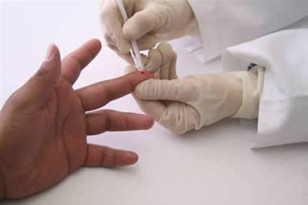 Reportan 16 casos de VIH  de los que 13 son varones