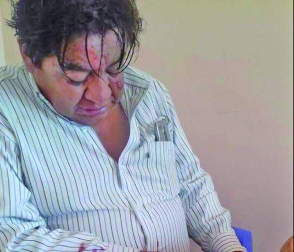 Viceministro se accidenta  y afirman que estaba ebrio