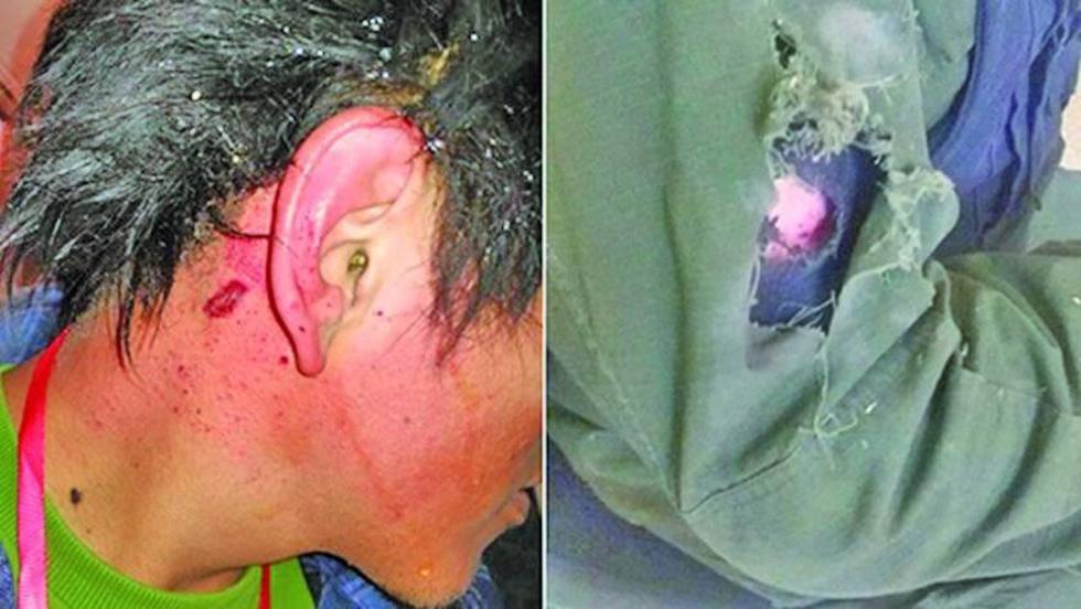 La Paz: camarógrafo y policía son heridos en una protesta de vecinos