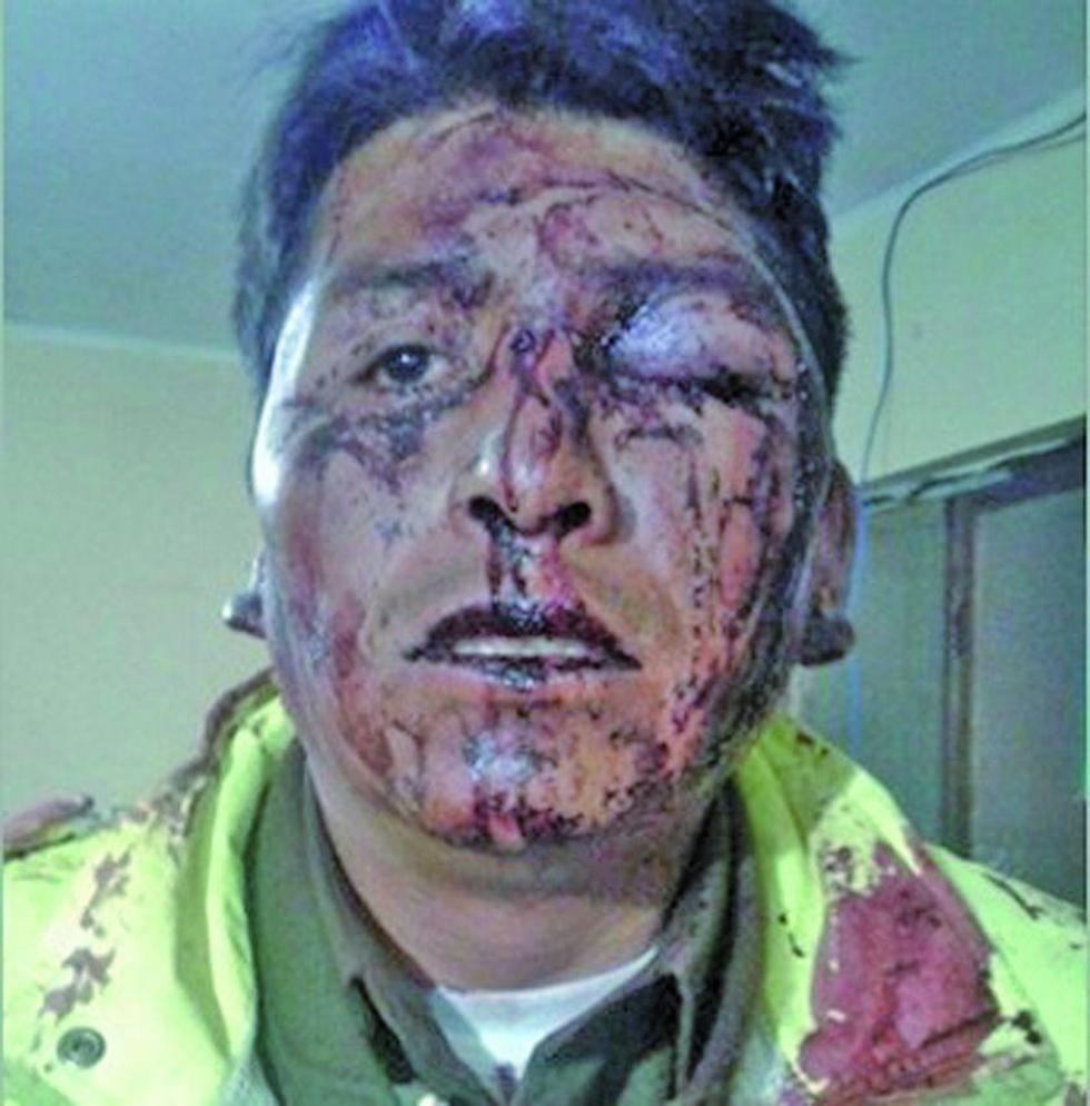 Chofer ebrio propinó una paliza a un policía