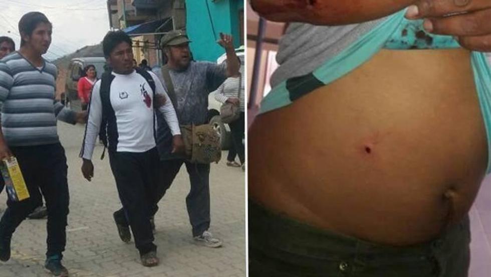 Enfrentamiento de cocaleros deja varios heridos en Coripata