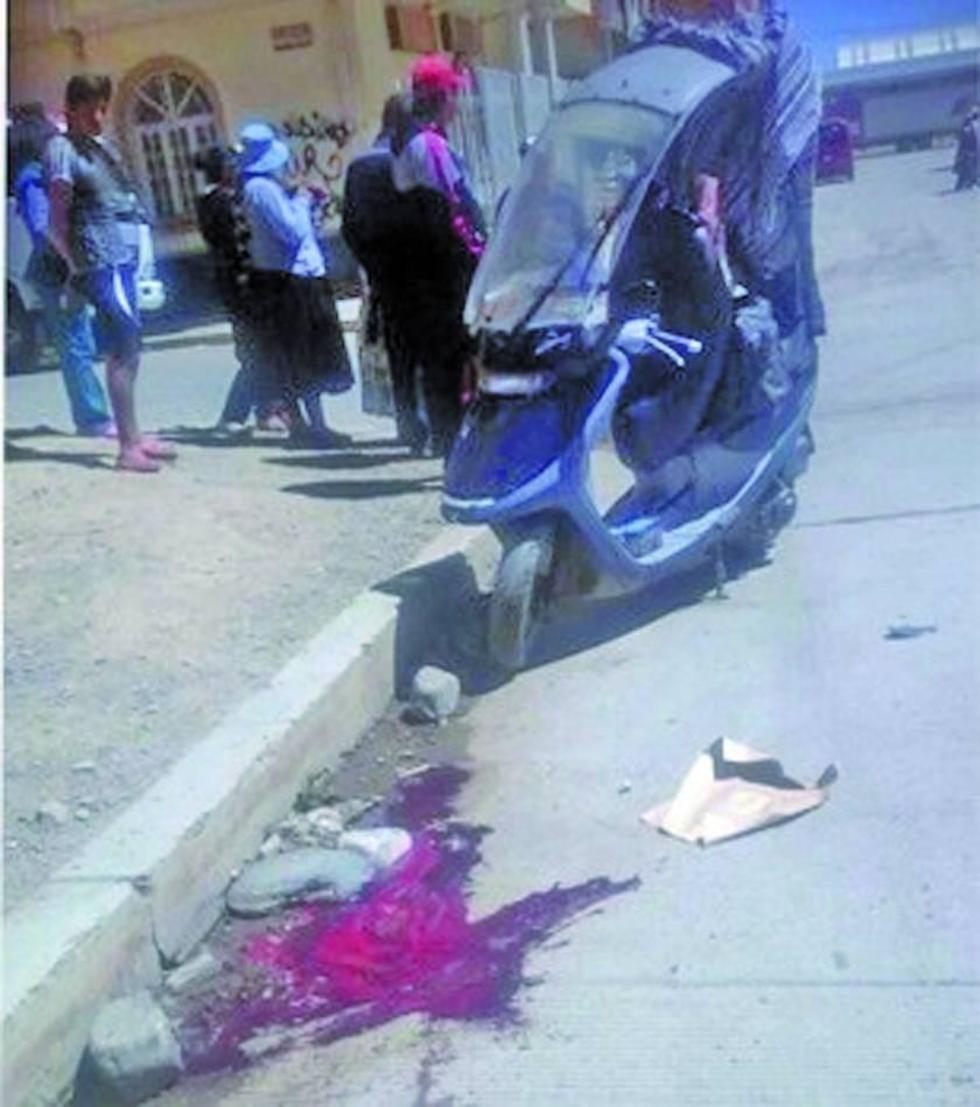 El Alto: un adulto mayor muere en un accidente vial 