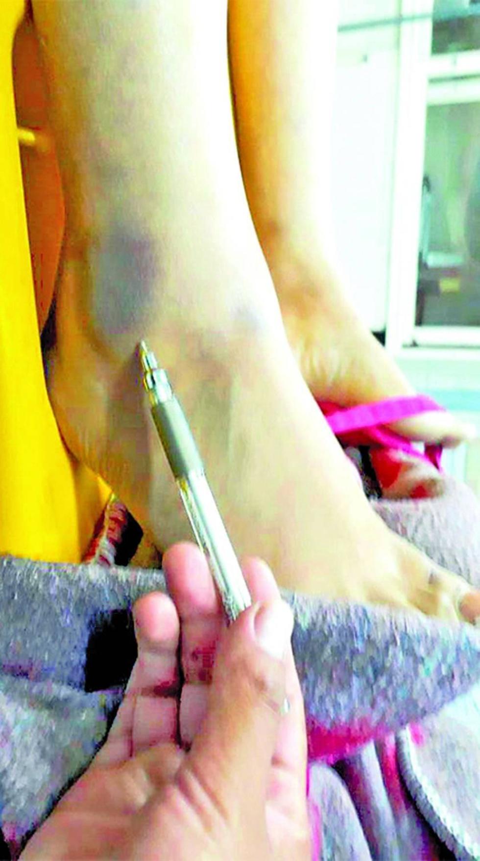 Hombre mata a golpes a su pareja en Villazón