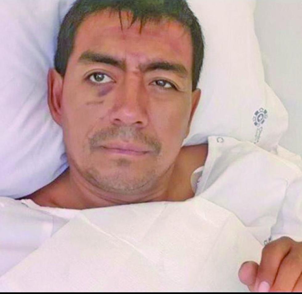 Fabricio Fuentes sigue en terapia intensiva