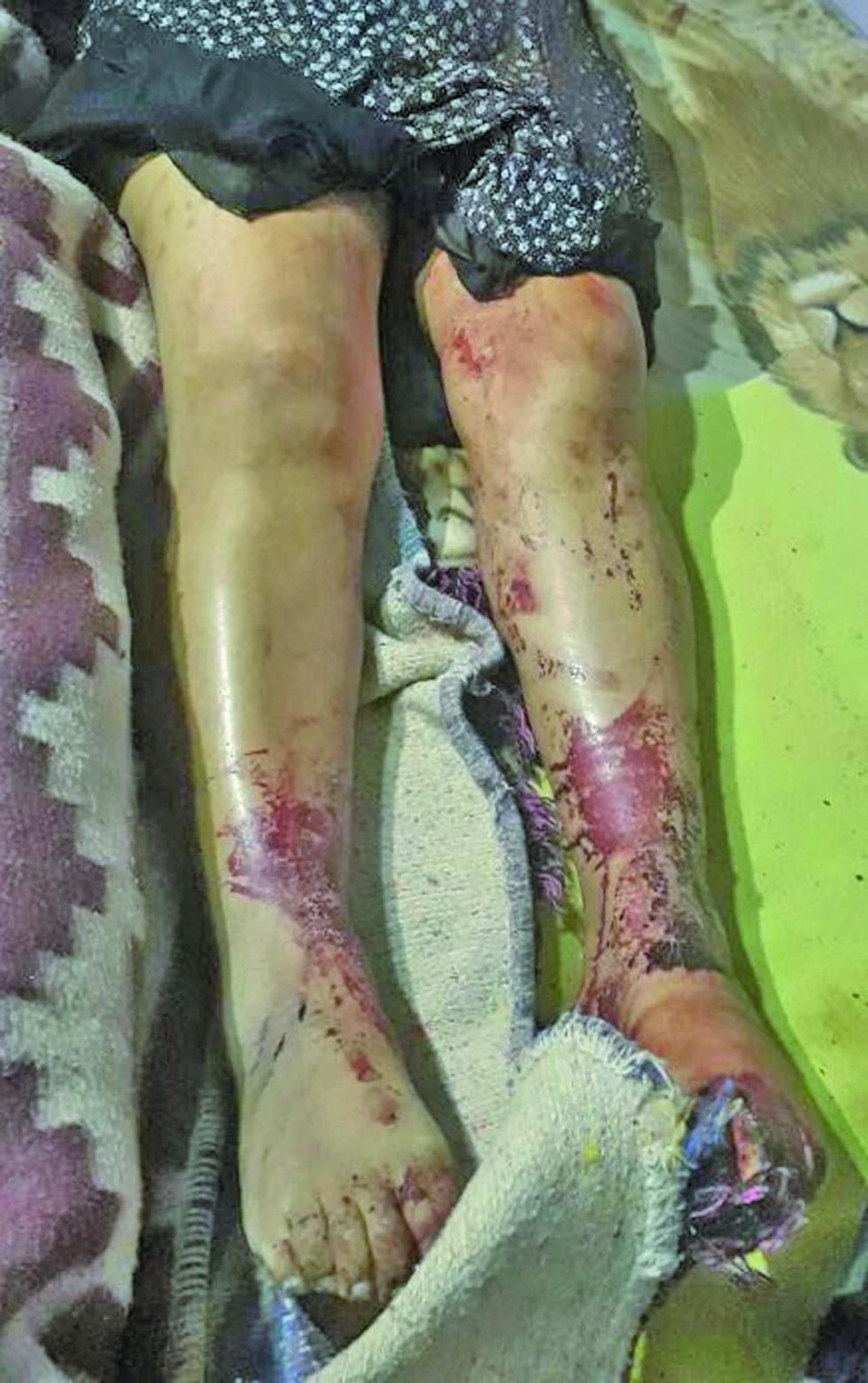 Chofer cercena seno de su mujer y se desangra hasta morir en Villazón