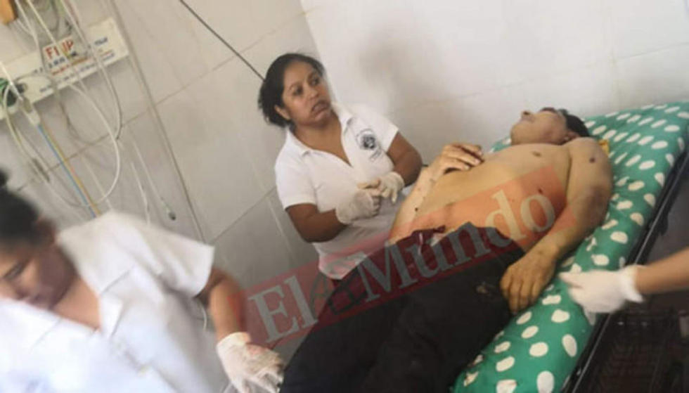 Policía: asesinan a balazos al exalcalde de San Matías