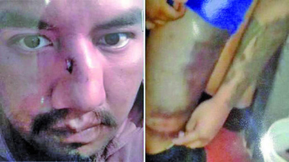 Trasladarán a Juan Pari de Chonchocoro luego que recibió una golpiza