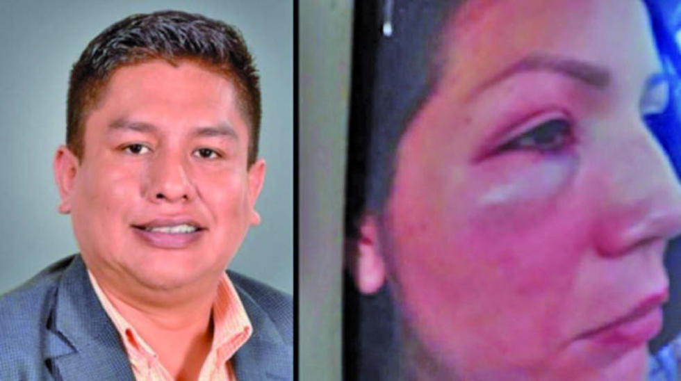 Expareja de Cabrera desiste de su denuncia de violencia