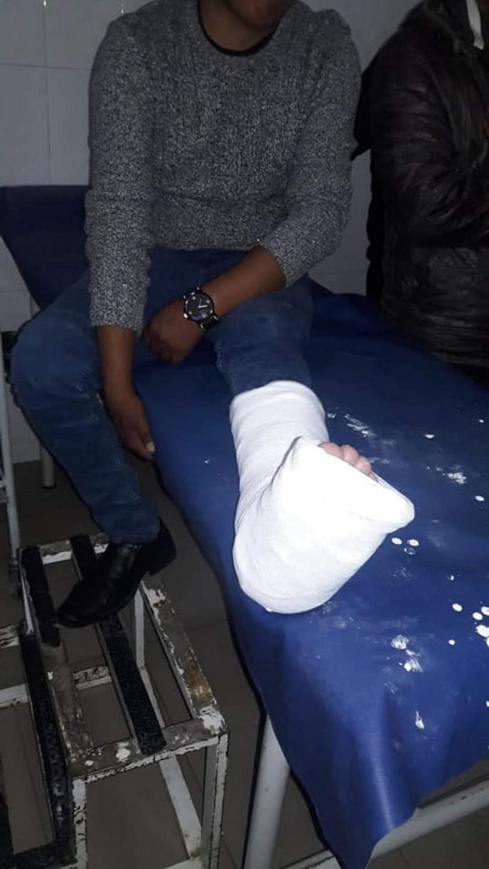 Motociclista se estrella contra un vehículo y hay un herido