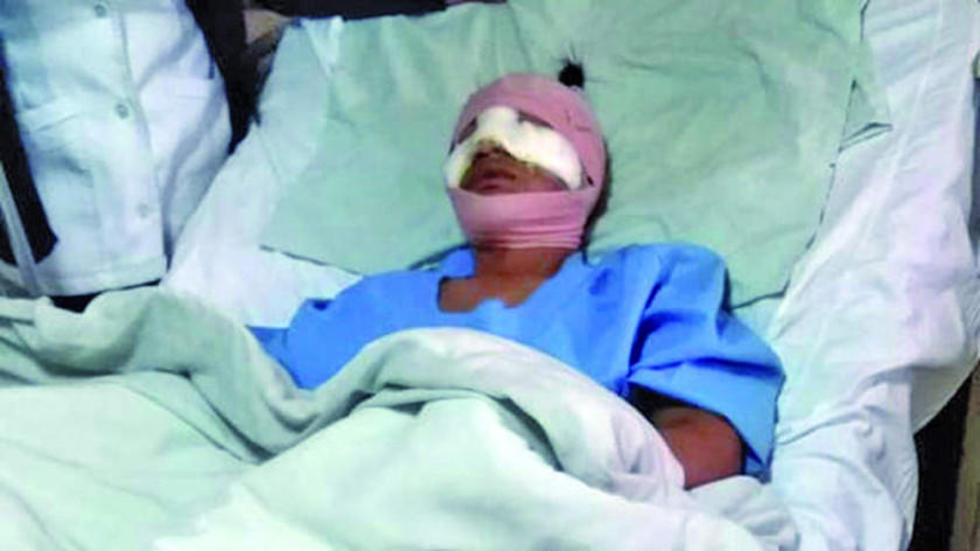 Joven que sufrió 13 cortes en el rostro necesita ayuda
