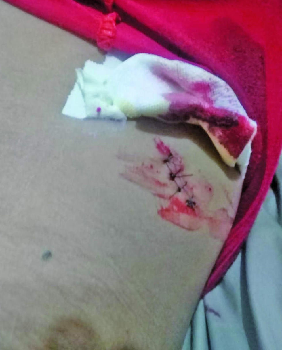 Joven apuñala a su hermano en la población de Porco