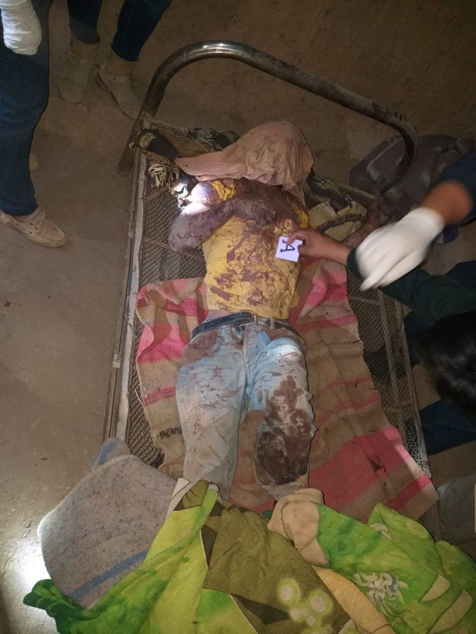Un anciano asesina a su hijo a machetazos 