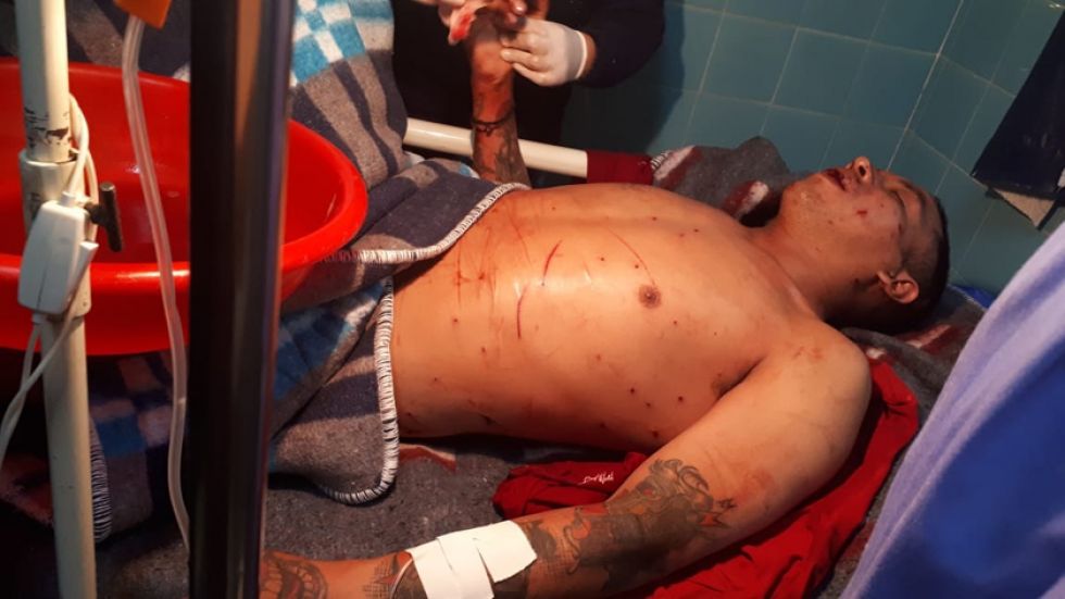 Un interno es herido en una riña en el penal de Villazón