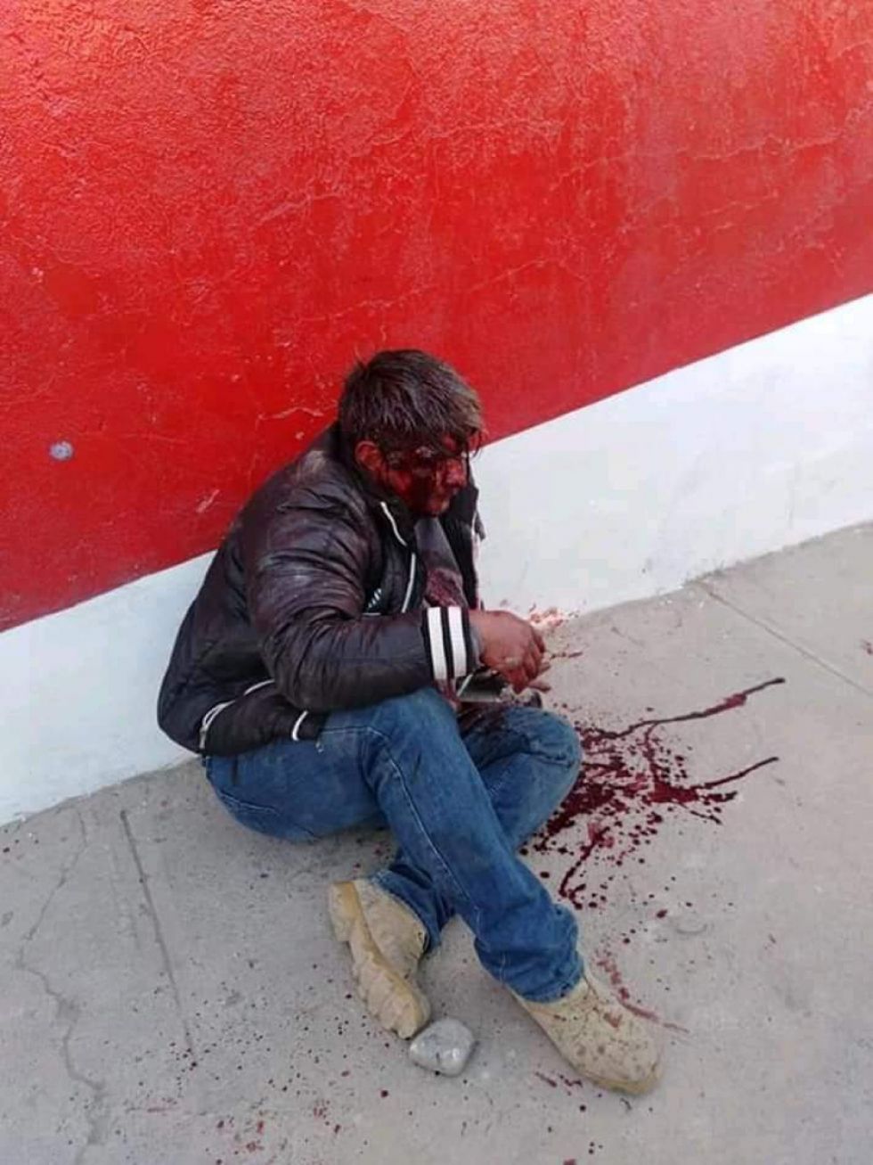 Avasalladores golpearon brutalmente a ciudadano