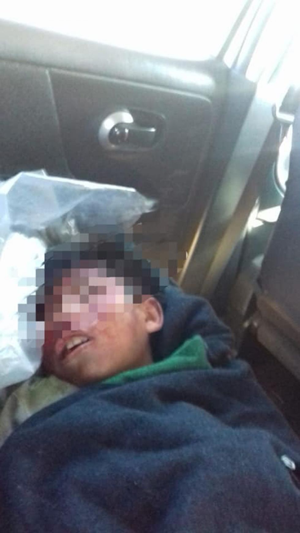 Joven es herido con un cuchillo de cocina