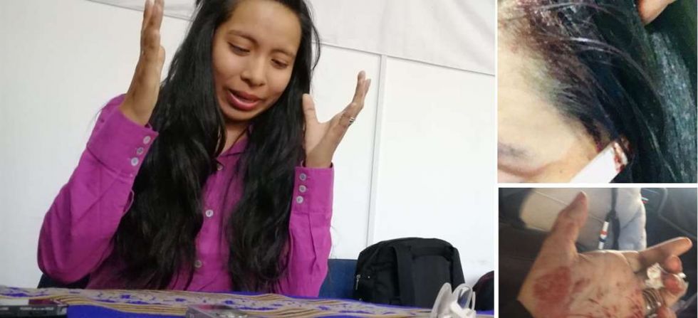 Piden que se investigue brutal agresión a una “pitita” en El Alto