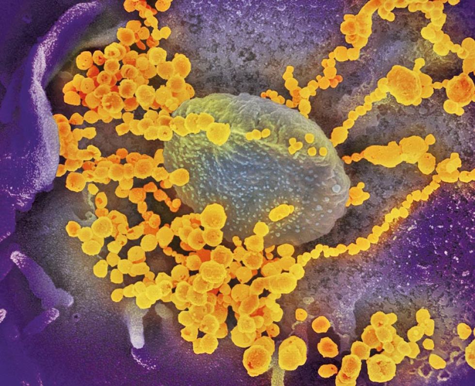 ¿Qué sabe la ciencia del nuevo coronavirus?