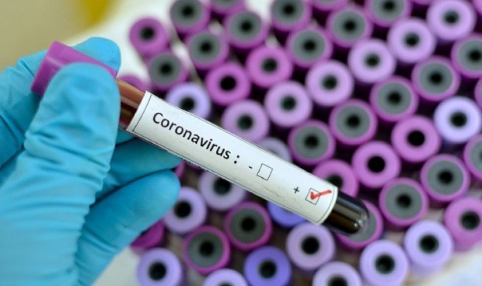 Los casos positivos por COVID-19 llegan a 300 en Bolivia