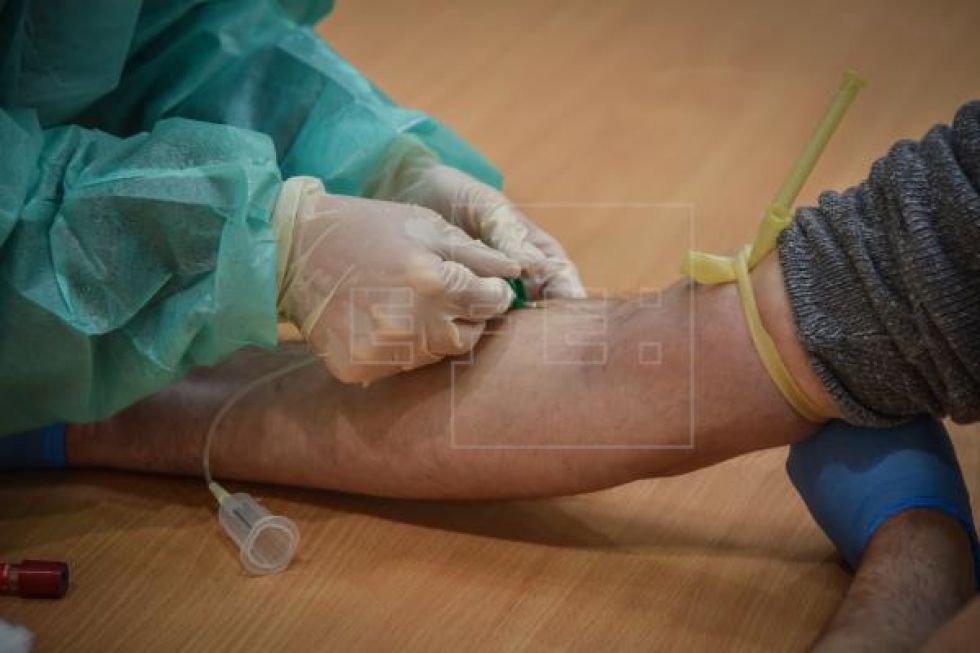 Italia reduce por primera vez el número de positivos por coronavirus