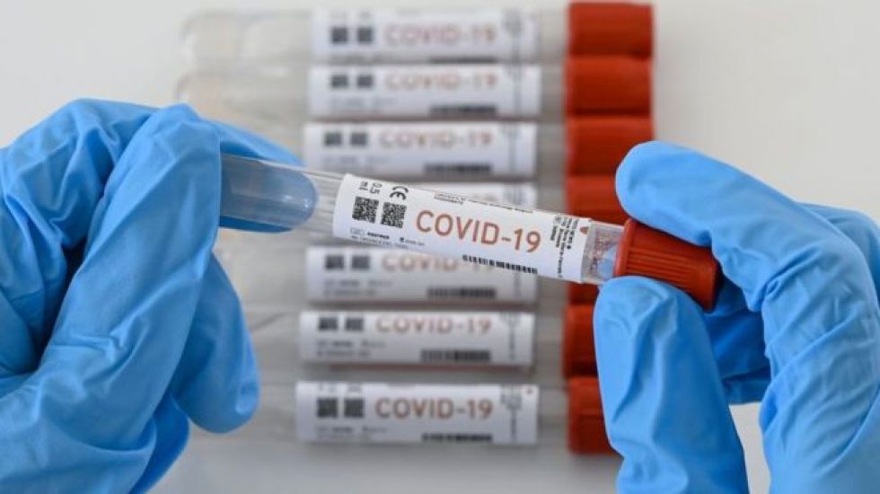 Biólogo molecular: Bolivia solo cuenta con datos de infectados por COVID-19 con síntomas graves