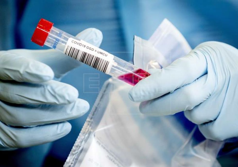 Los contagios globales diarios llegan a casi 130.000 casos, un nuevo récord