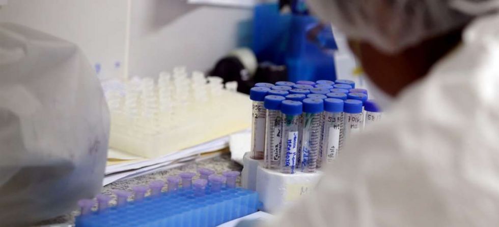 Ministerio de Salud anuncia que hasta fin de mes distribuirá 50.000 pruebas para diagnosticar coronavirus