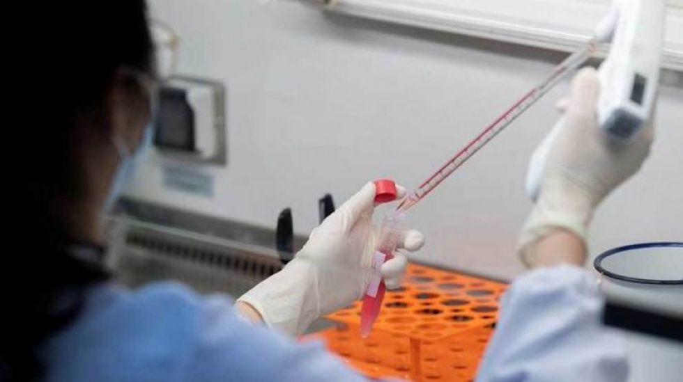 Eli Lilly probará en humanos un tratamiento de anticuerpos contra el covid-19