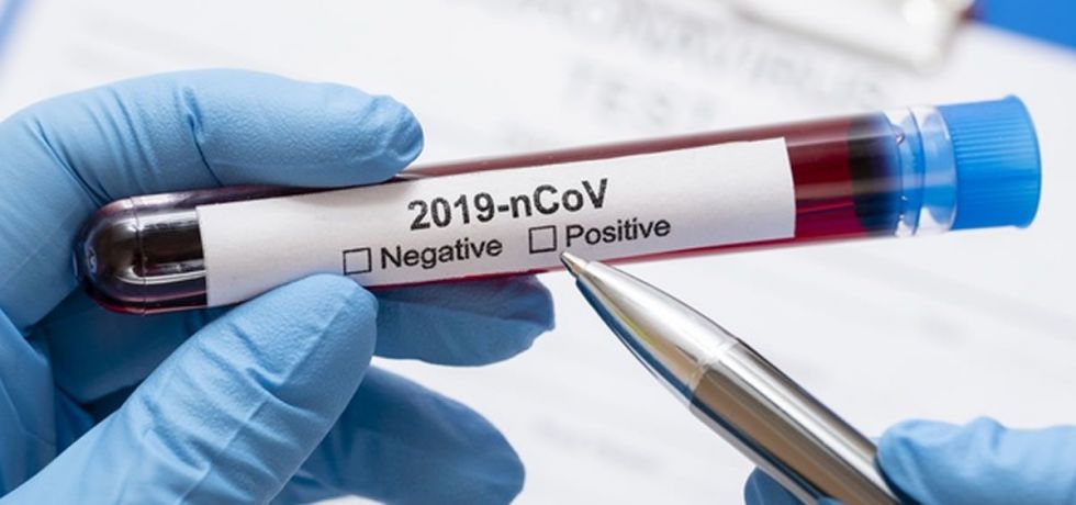Más de una veintena de autoridades cruceñas se han infectado con el coronavirus
