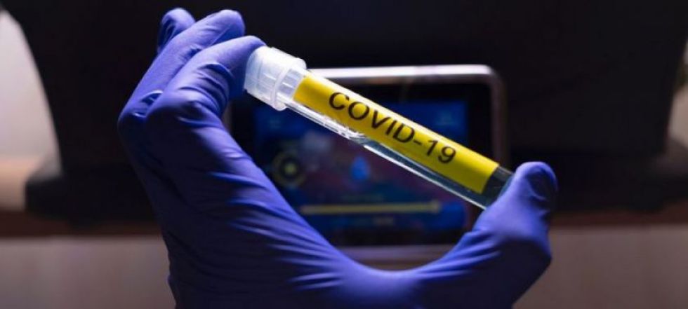 La OMS ve factible una vacuna contra la COVID-19 para principios de 2021