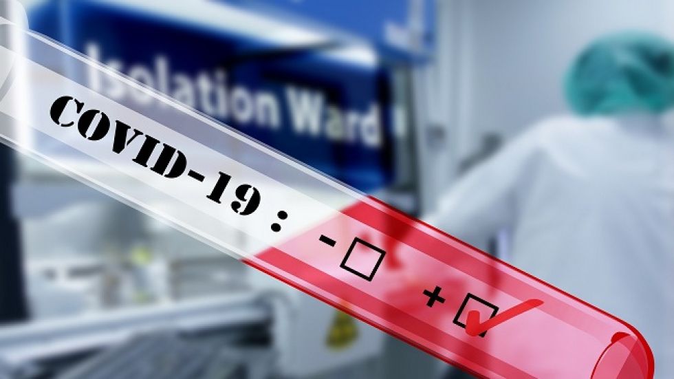 La CE busca más financiación para una vacuna global contra el coronavirus