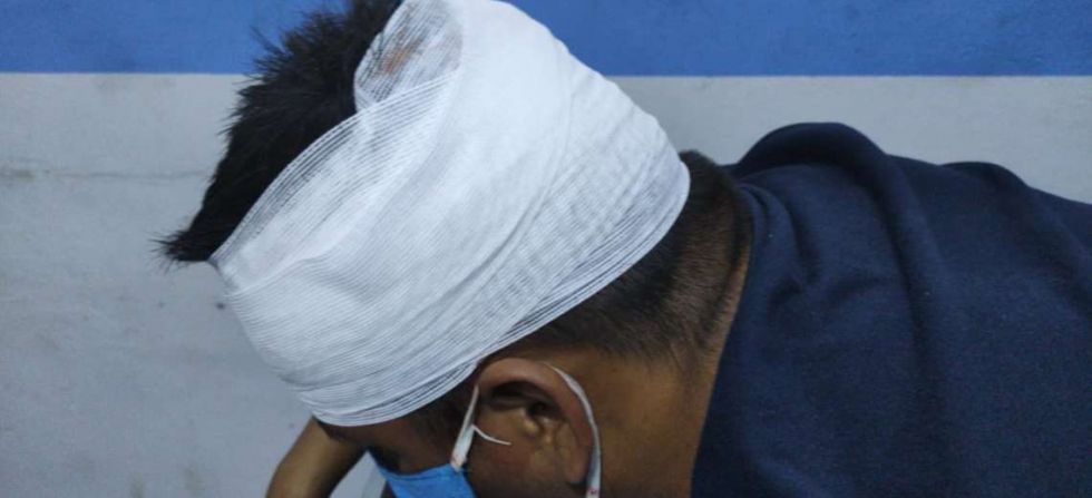 Santa Cruz: Padre e hijo son heridos durante un asalto en tienda de abarrotes