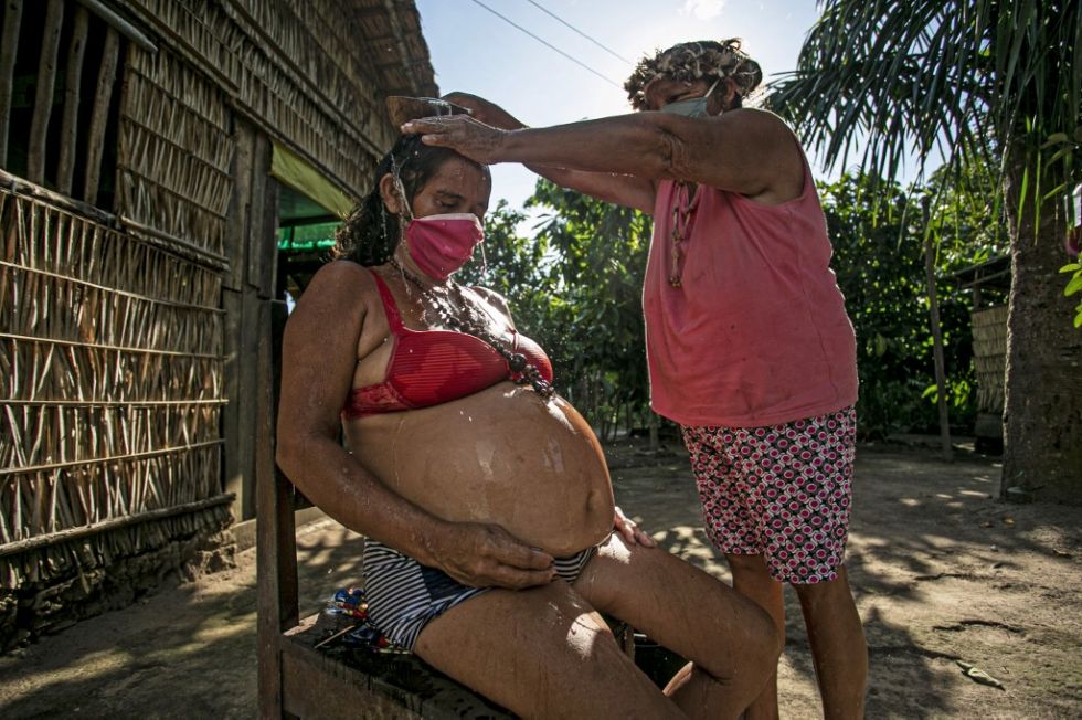 La OPS dice que embarazadas pueden sufrir forma grave de COVID-19