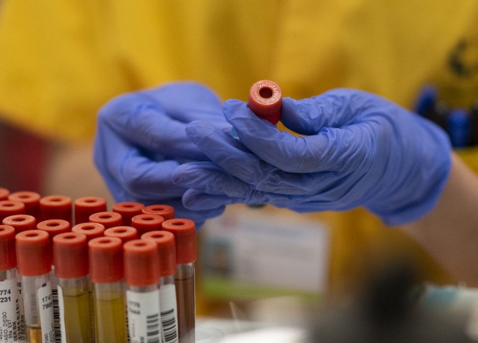 Suecia detecta que tests chinos dieron 3.700 falsos positivos
