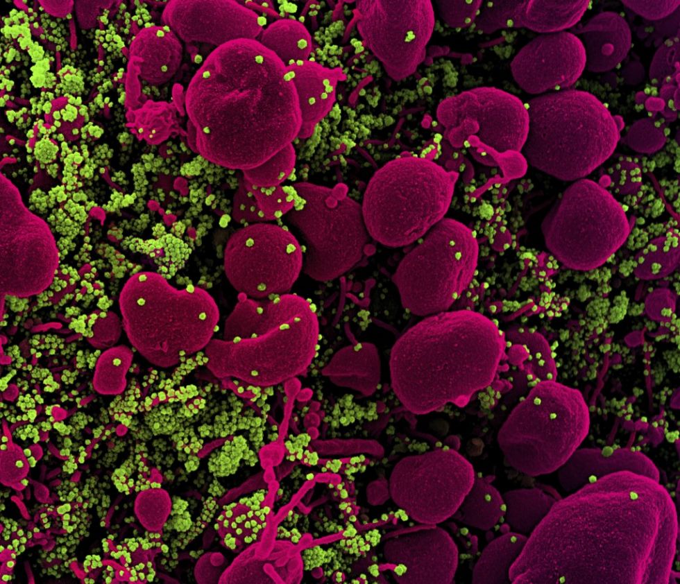 Según estudio, un repelente para insectos puede matar al coronavirus