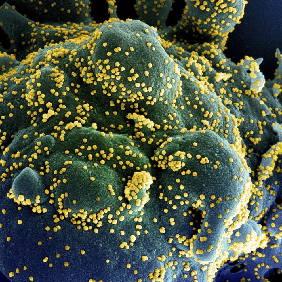 Estudio revela que el coronavirus puede invadir el cerebro