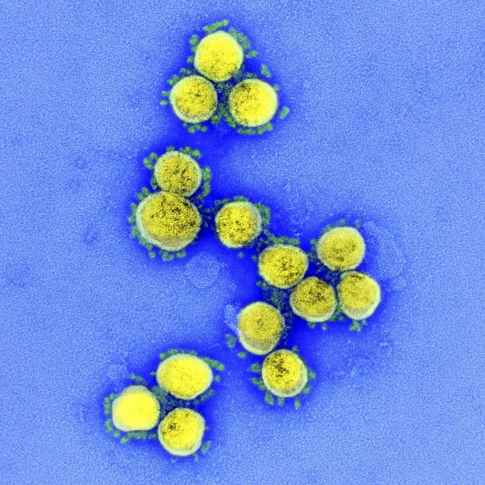 Roche lanza ensayo cuantitativo de anticuerpos contra el SARS-CoV-2