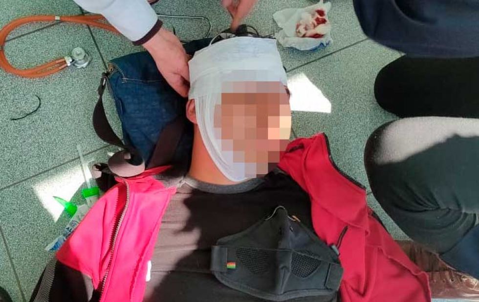El Alto: Reportan detenidos y varios heridos por intervención policial a protesta laboral