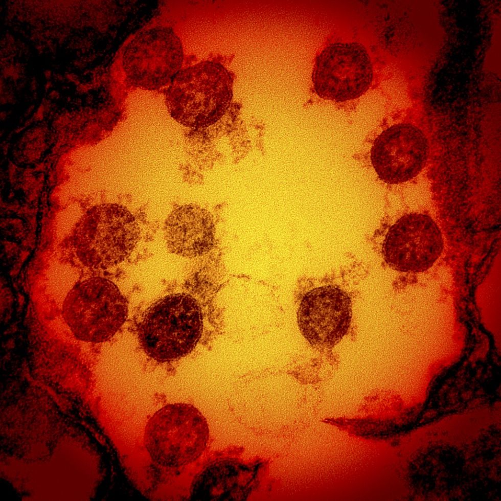 El coronavirus pone en peligro los logros en la lucha contra la tuberculosis