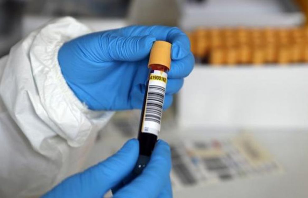 El Sedes sostiene que el coronavirus aún circula en el Departamento de Potosí