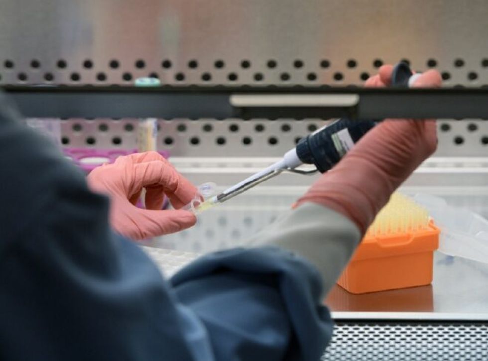 Casos nuevos de VIH en Latinoamérica aumentaron 21% en la última década, revela OPS