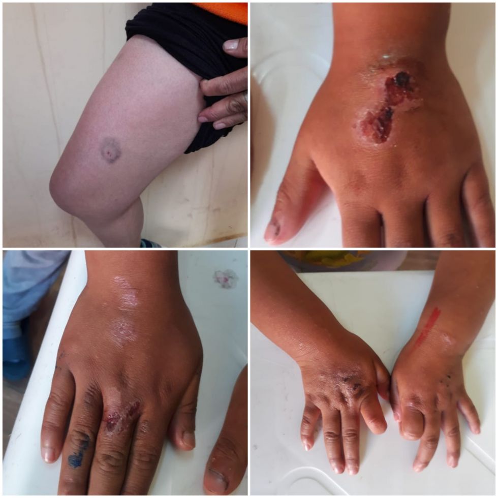 Aprehenden a madre y padrastro por torturar a dos pequeños niños