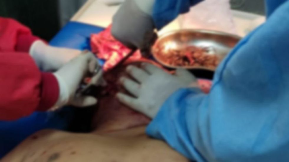 Sucre: Seis perros atacan a un joven con síndrome de Down