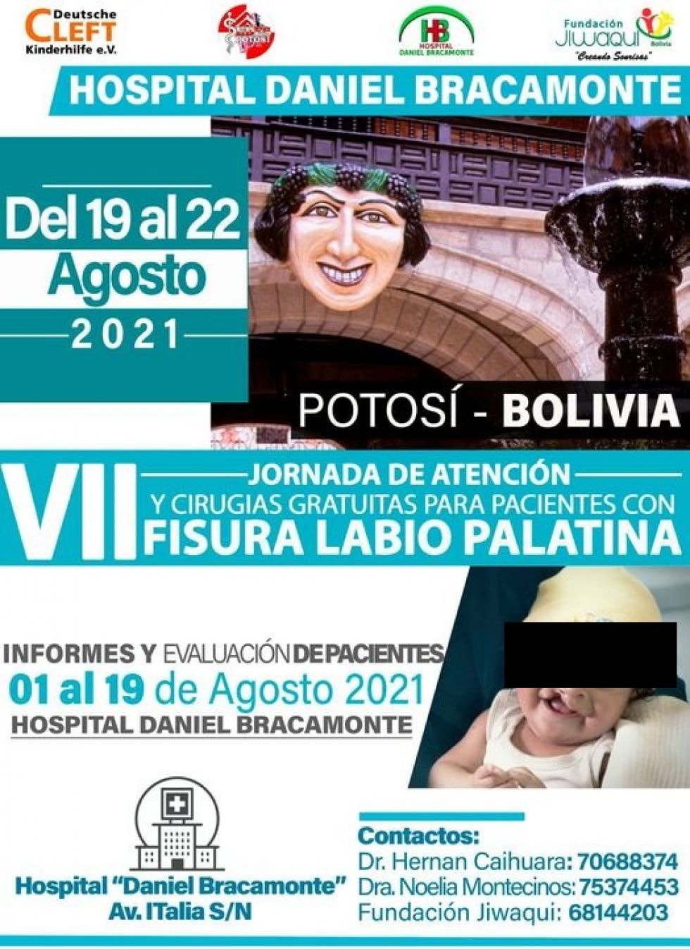 Se desarrolla la séptima jornada de cirugías gratuitas de fisura labio palatina