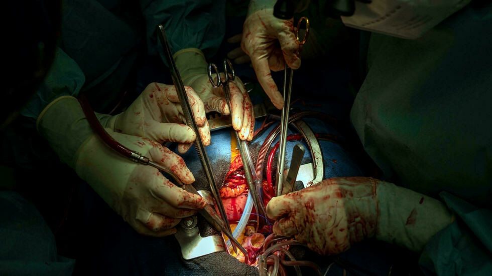 La pandemia complica más la frenética carrera para un trasplante