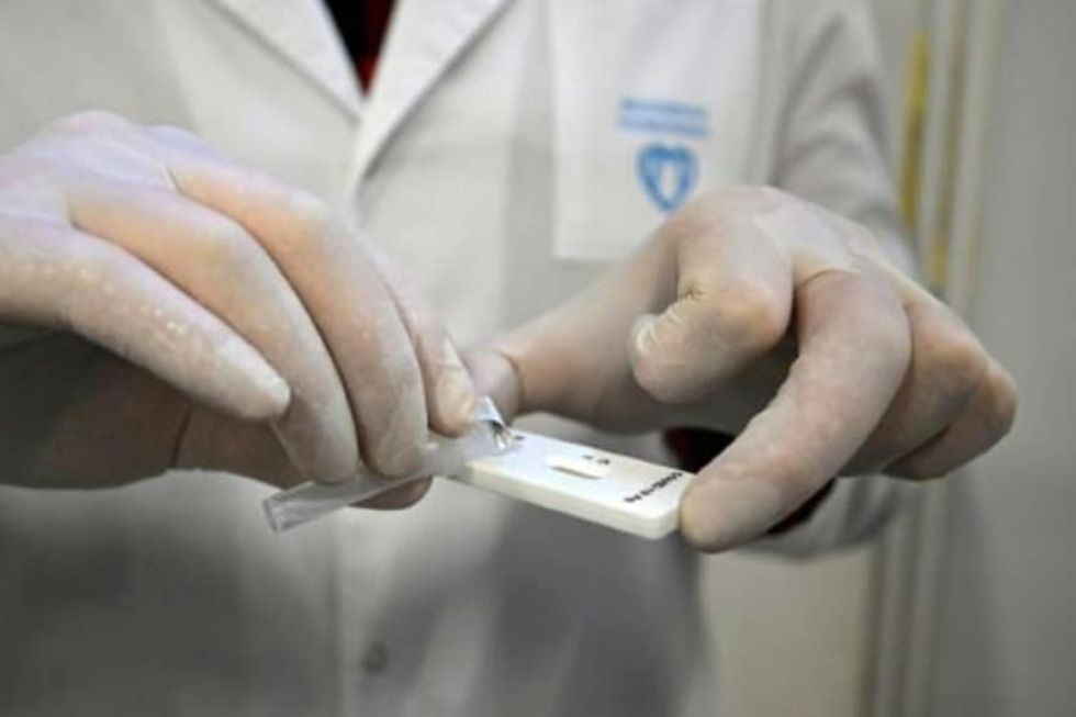 Rusia defiende la imposición de exámenes médicos para los extranjeros