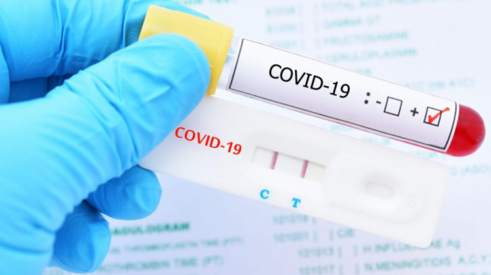 Agemed advierte que venta de reacctivos de diagnóstico para Covid en redes sociales y farmacias está prohibida