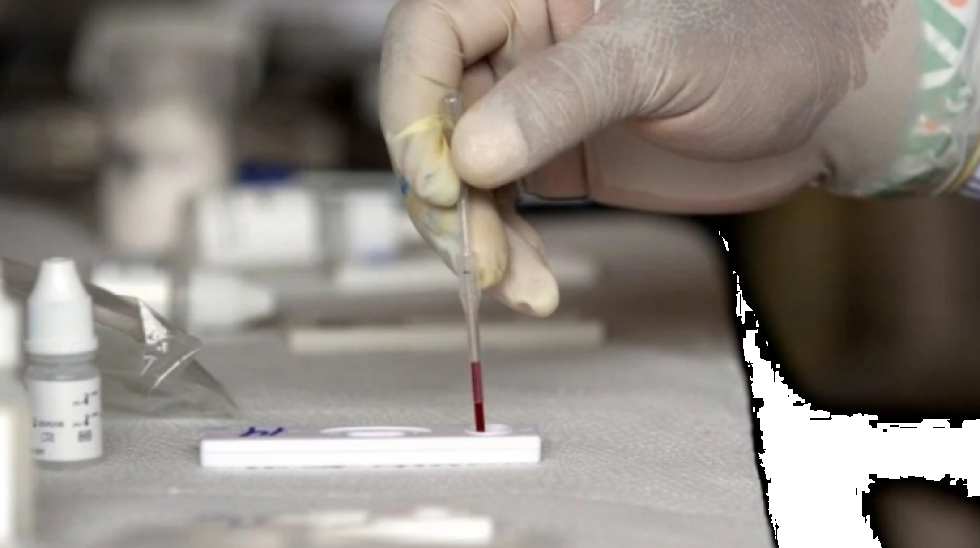 ¿Qué conoce de la hepatitis aguda? un experto de la OPS responde ocho preguntas